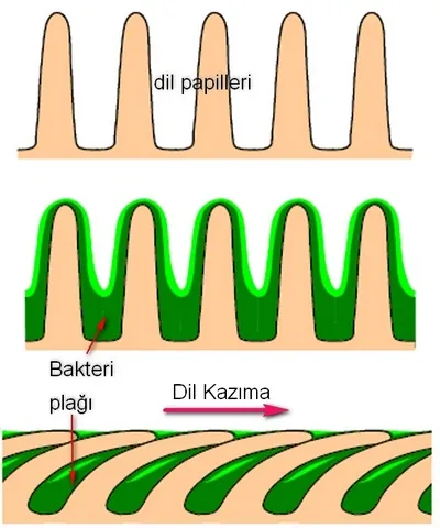 Kazınan dil papilleri